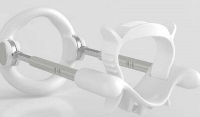 Extender per aumentare un membro